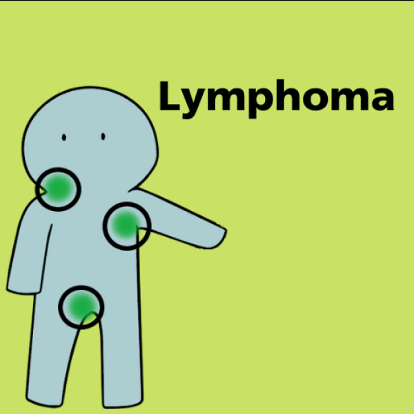 Lymphoma Irish Cancer Society